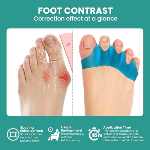 Welnove Silikon-Zehenspreizer für Hallux Valgus Korrektur – 8er-Pack Zehenspacer für Männer und Frauen, Hammerzehen-Richtgerät, Yoga-Übungen, Fußausrichtung, FSA- oder HSA-berechtigt