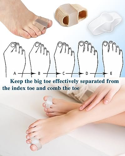 PGRODE 4er-Pack Zehenspreizer für Hallux-Valgus-Korrektur, Großzehenstrecker mit elastischem Hammerzeh-Korrektor, Zehentrenner für Damen und Herren, mit 2 Schlaufen (2 Nylon + 2 Gel)