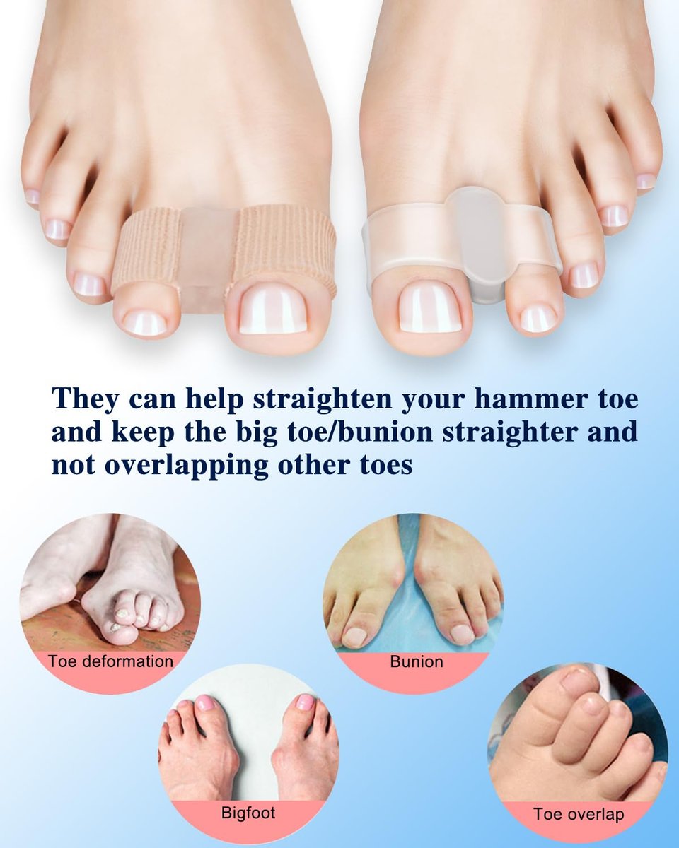 PGRODE 4er-Pack Zehenspreizer für Hallux-Valgus-Korrektur, Großzehenstrecker mit elastischem Hammerzeh-Korrektor, Zehentrenner für Damen und Herren, mit 2 Schlaufen (2 Nylon + 2 Gel)