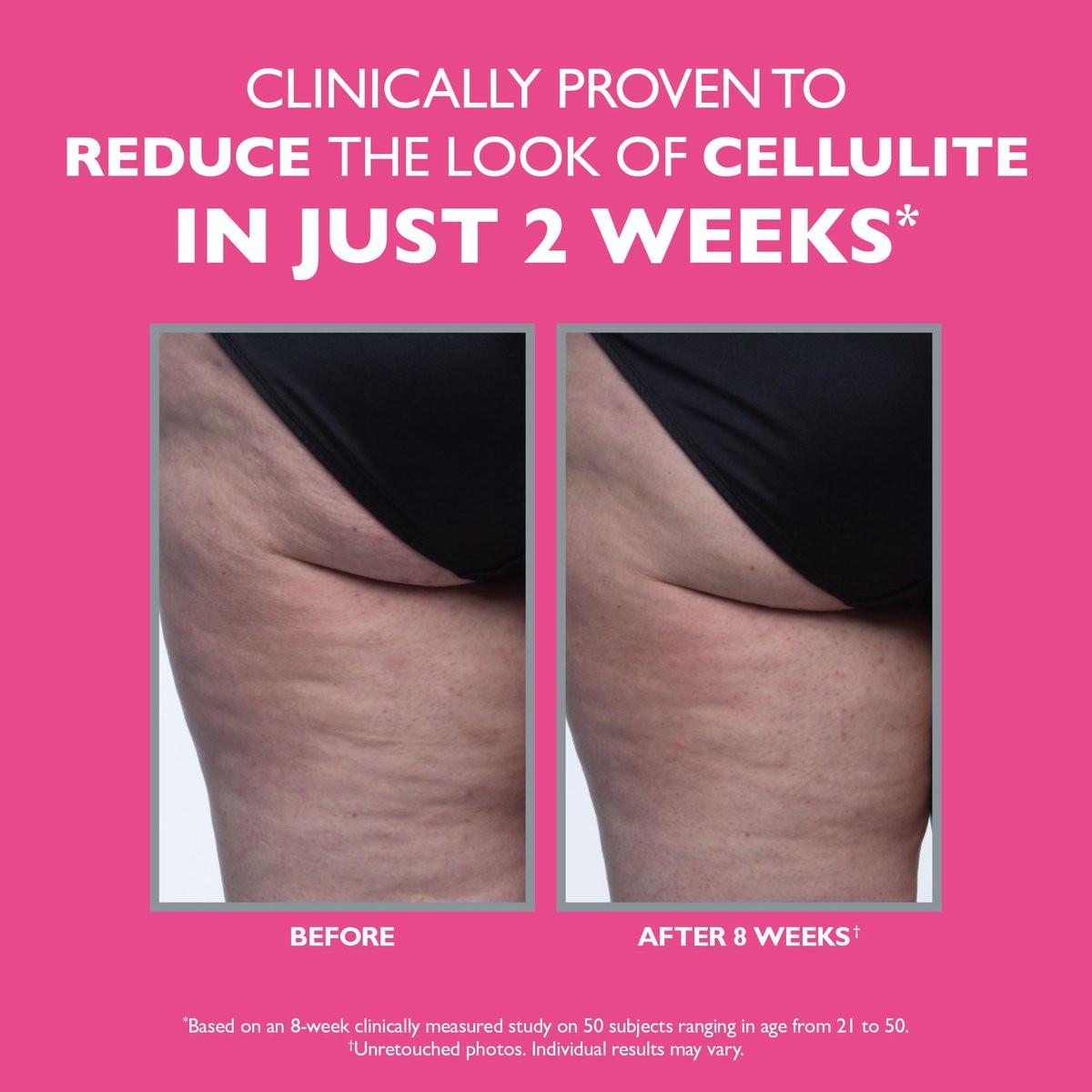 Peter Thomas Roth FIRMx® Tight & Toned Cellulite Treatment – Körpercreme gegen Cellulite, klinisch getestet für sichtbare Ergebnisse in nur 2 Wochen, 100 ml