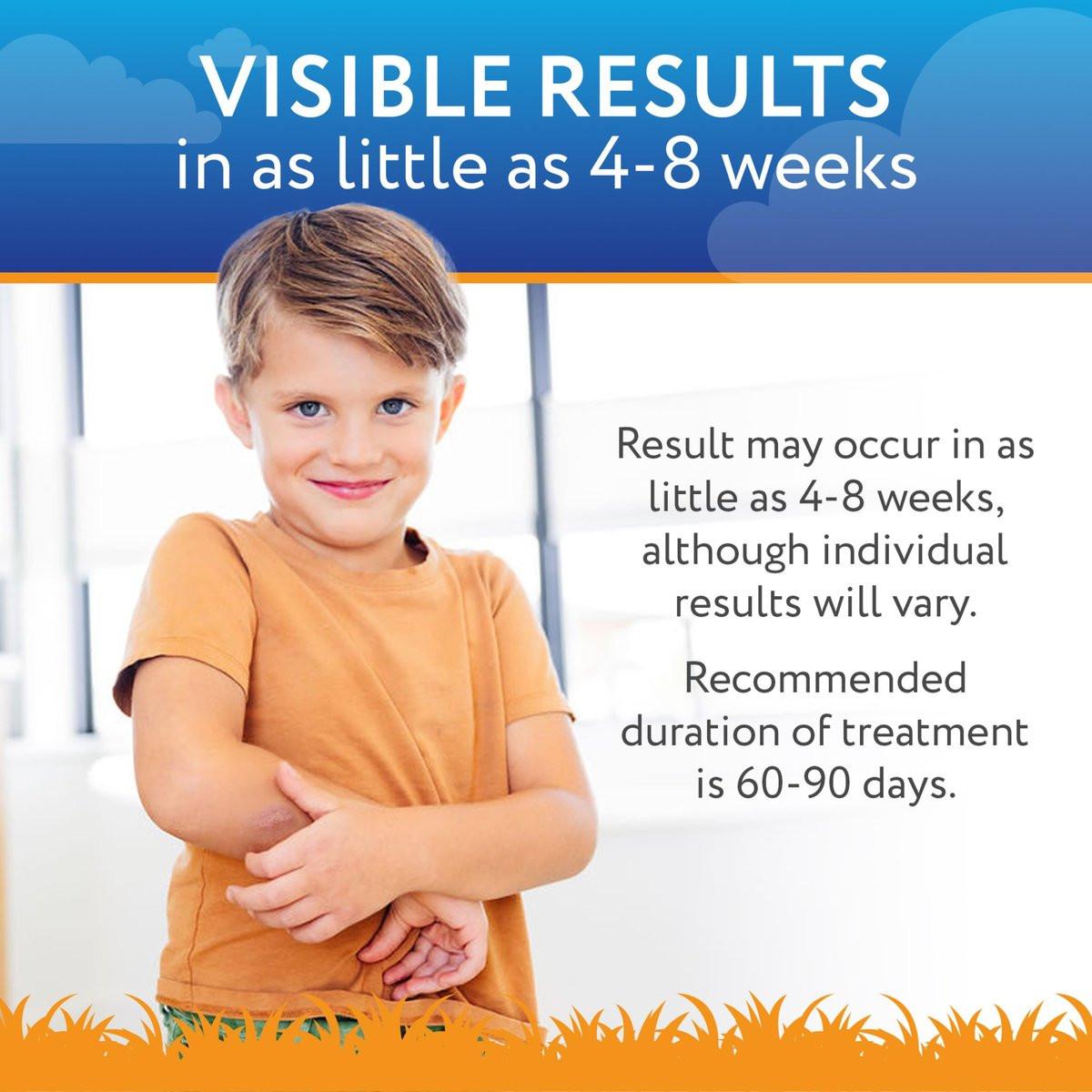ScarAway Kids Silikon-Narbengel, 100% medizinische Qualität, hilft bei der Verbesserung von Größe, Farbe und Textur hypertropher und Keloide Narben im Gesicht und am Körper durch Verletzungen, Verbrennungen und Operationen, wasserbeständig, klar, 6 g