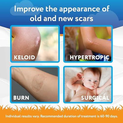 ScarAway Kids Silikon-Narbengel, 100% medizinische Qualität, hilft bei der Verbesserung von Größe, Farbe und Textur hypertropher und Keloide Narben im Gesicht und am Körper durch Verletzungen, Verbrennungen und Operationen, wasserbeständig, klar, 6 g