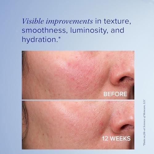 iS Clinical Retinol+ Emulsion 0,3 – Anti-Aging Gesichtscreme zur Reduzierung von feinen Linien und Fältchen, für einen ebenmäßigen Teint