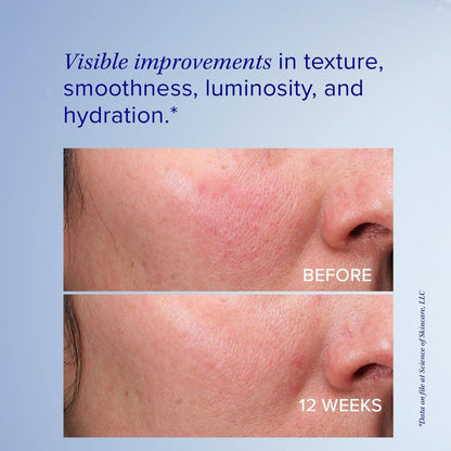 iS Clinical Retinol+ Emulsion 0,3 – Anti-Aging Gesichtscreme zur Reduzierung von feinen Linien und Fältchen, für einen ebenmäßigen Teint