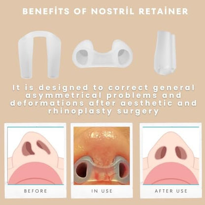 Nasenretainer für Rhinoplastik-Erholung | Nasenformer & Stützgerät aus 100% hochwertigem Silikon | Postoperative Nasenformung & Heilungshilfe (Größe 7)