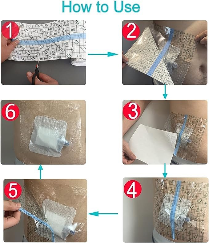 6x6 Zoll wasserdichte Duschabdeckung für große Wunden – 25 Stück, transparente Klebebandagen ohne Kleber in der Mitte, postoperativer Wasserschutz