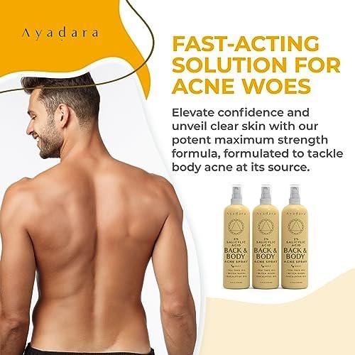 AYADARA Akne Körper Spray mit 2% Salicylsäure – gegen Rückenakne, Körperakne, Zystische Akne, Hormonelle Akne für Jugendliche & Erwachsene, 3er-Pack (4 Fl Oz pro Flasche)