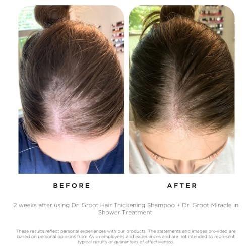 Dr. Groot Haarverdickendes Shampoo, Koreanische Haarpflege mit Biotin und Rosmarinöl, 13,01 Fl Oz