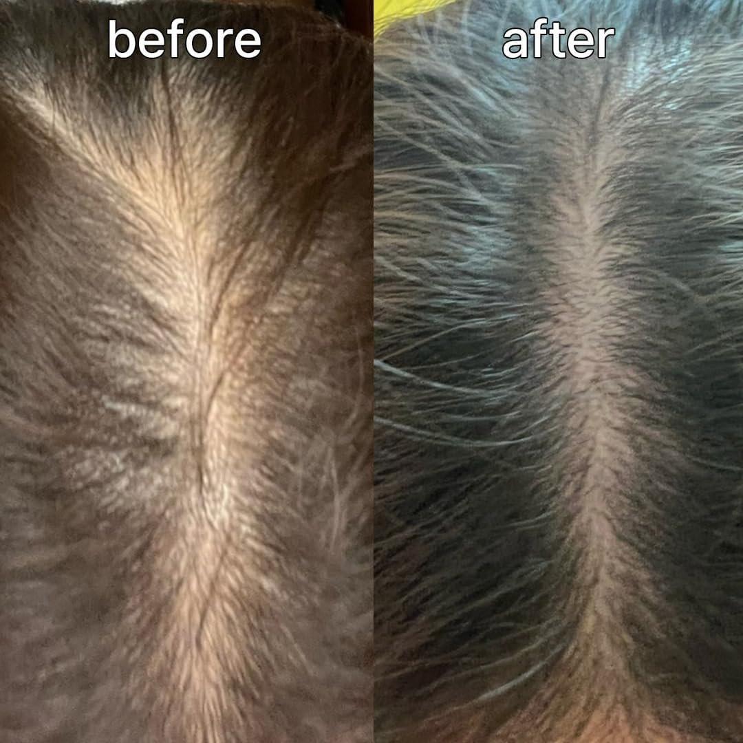 Scalp&Hair Serum für dünner werdendes Haar von Vivelab, 15 ml – klinisch getestet, nährende Formel mit Biotin und Peptiden. Fördert eine gesunde Kopfhaut und voller aussehendes Haar