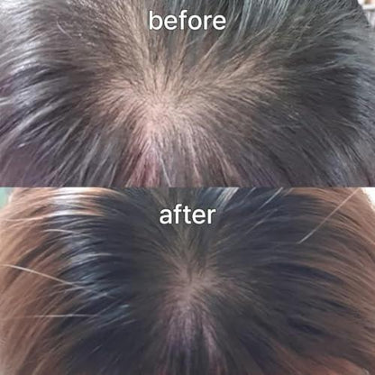 Scalp&Hair Serum für dünner werdendes Haar von Vivelab, 15 ml – klinisch getestet, nährende Formel mit Biotin und Peptiden. Fördert eine gesunde Kopfhaut und voller aussehendes Haar
