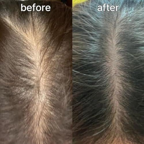 Scalp&Hair Serum für dünner werdendes Haar von Vivelab, 15 ml – klinisch getestet, nährende Formel mit Biotin und Peptiden. Fördert eine gesunde Kopfhaut und voller aussehendes Haar