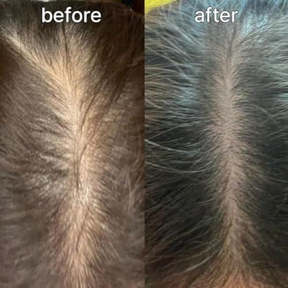Scalp&Hair Serum für dünner werdendes Haar von Vivelab, 15 ml – klinisch getestet, nährende Formel mit Biotin und Peptiden. Fördert eine gesunde Kopfhaut und voller aussehendes Haar