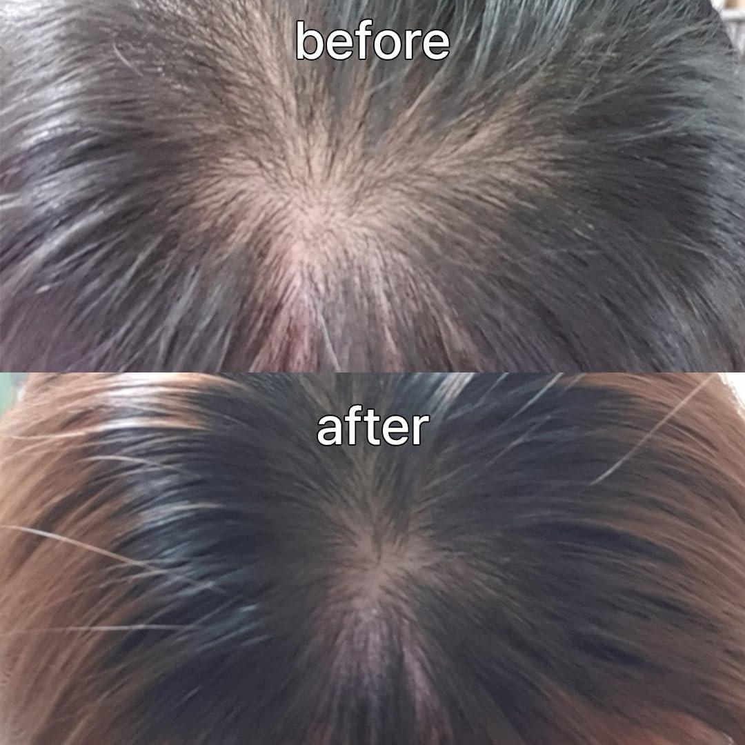 Scalp&Hair Serum für dünner werdendes Haar von Vivelab, 15 ml – klinisch getestet, nährende Formel mit Biotin und Peptiden. Fördert eine gesunde Kopfhaut und voller aussehendes Haar