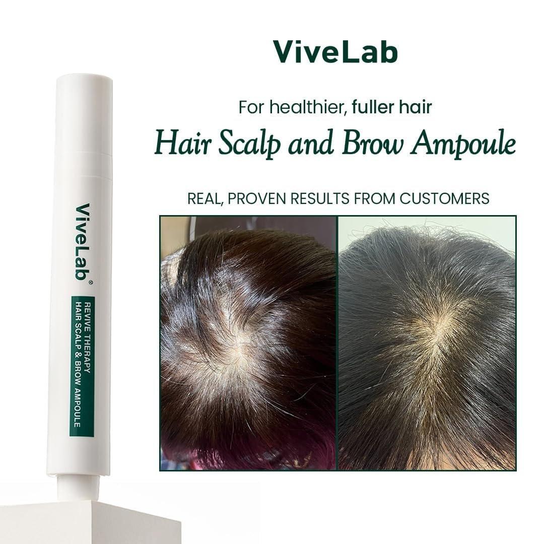 Scalp&Hair Serum für dünner werdendes Haar von Vivelab, 15 ml – klinisch getestet, nährende Formel mit Biotin und Peptiden. Fördert eine gesunde Kopfhaut und voller aussehendes Haar