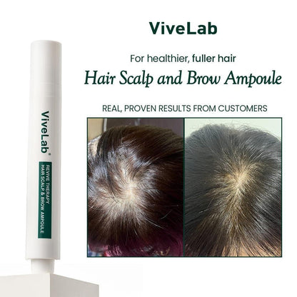 Scalp&Hair Serum für dünner werdendes Haar von Vivelab, 15 ml – klinisch getestet, nährende Formel mit Biotin und Peptiden. Fördert eine gesunde Kopfhaut und voller aussehendes Haar