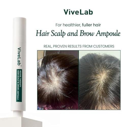 Scalp&Hair Serum für dünner werdendes Haar von Vivelab, 15 ml – klinisch getestet, nährende Formel mit Biotin und Peptiden. Fördert eine gesunde Kopfhaut und voller aussehendes Haar