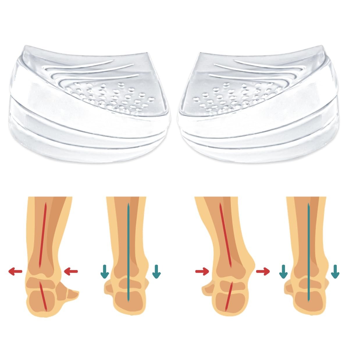 Skyfoot 3-Lagen Verstellbare Fersenkeil-Einlagen zur Korrektur von Supination & Pronation, Klebende mediale & laterale Fersenpolster für O-Beine, Knieschmerzen, Fußausrichtung (L: Damen 7-11, Herren 7-10, Kristall)