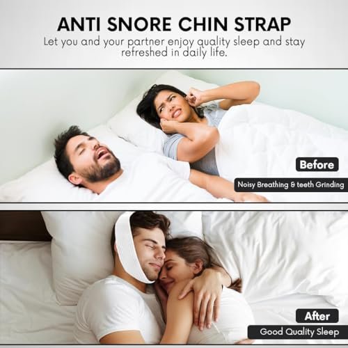 Bistras Super Deluxe Weißes Kinnband für CPAP-Benutzer - Gegen Mundtrockenheit und Schnarchen - Hält den Mund während des Schlafs geschlossen (1 Stück)