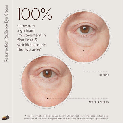True Botanicals Resurrection Radiance Brightening Eye Cream – Reduziert dunkle Augenringe, feine Linien, Fältchen & Schwellungen | Dermatologisch getestet, natürlich, vegan | 0,5 oz (15 ml)