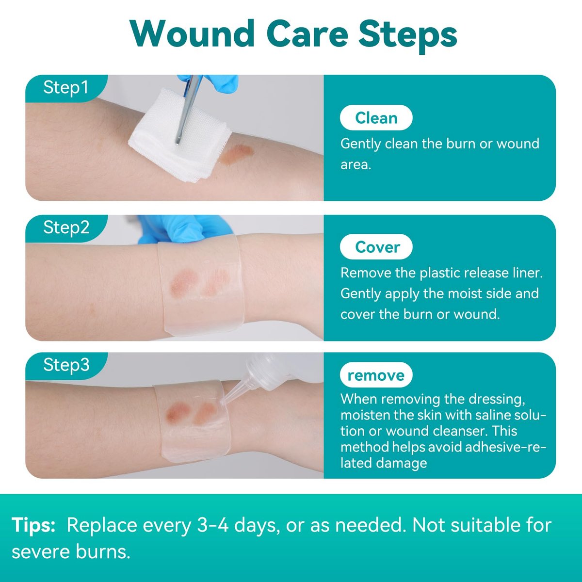 Dimora Hydrogel-Wundauflage 1,7" x 3" – Kühlende & beruhigende sterile Brandpflaster für kleine Verbrennungen, Blasen, Schürfwunden, rissige Brustwarzen – 10 Stück