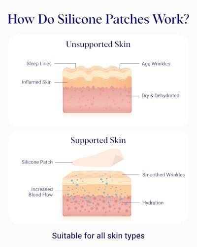 Wrinkles Schminkles Gesichtsglättungsset – Mund- & Lippen-Pads (2er-Pack), Augen-Faltenpflaster (3 Paare), Stirn-Faltenpflaster (2er-Pack) – Wiederverwendbare, hautfreundliche Silikon-Glättungspads