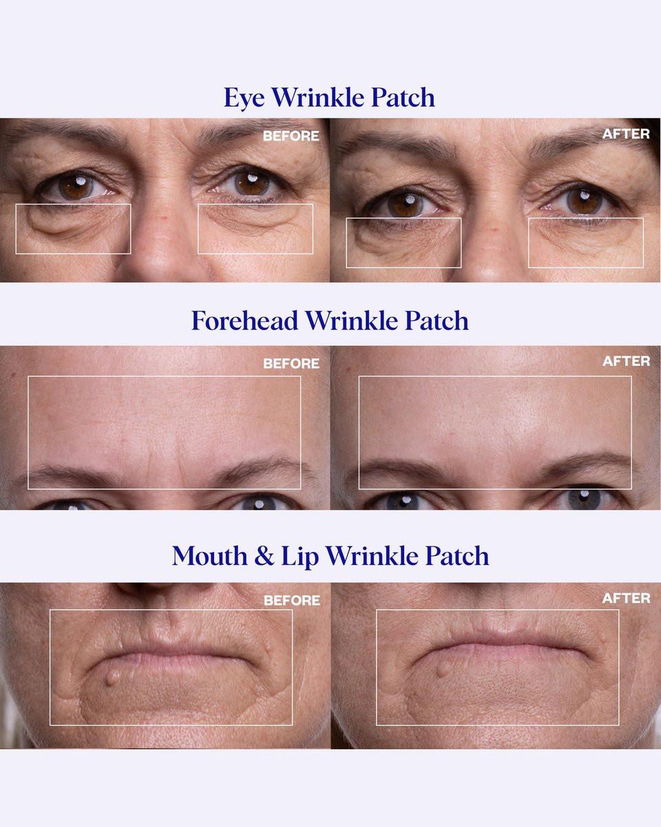 Wrinkles Schminkles Gesichtsglättungsset – Mund- & Lippen-Pads (2er-Pack), Augen-Faltenpflaster (3 Paare), Stirn-Faltenpflaster (2er-Pack) – Wiederverwendbare, hautfreundliche Silikon-Glättungspads
