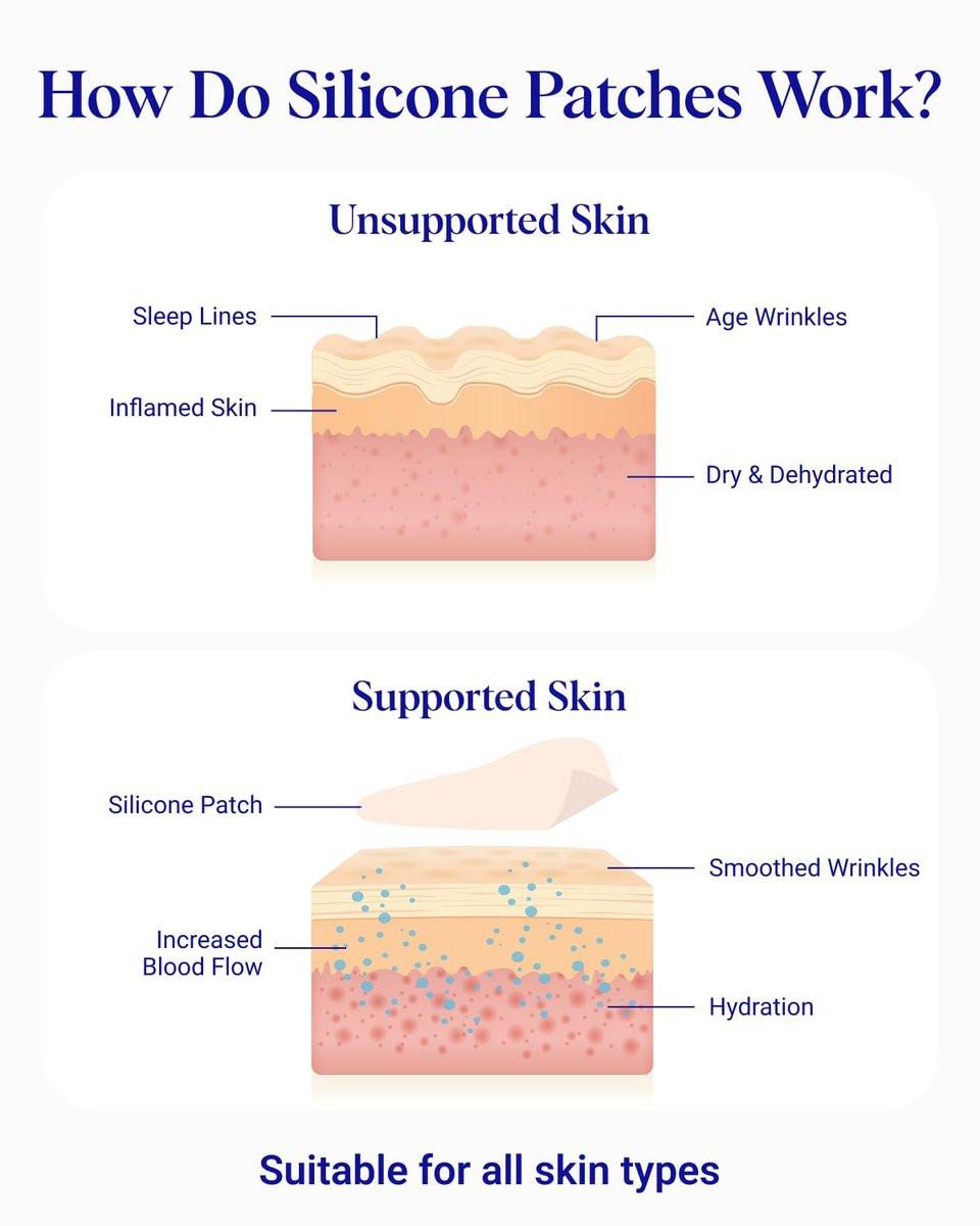 Wrinkles Schminkles Gesichtsglättungsset – Mund- & Lippen-Pads (2er-Pack), Augen-Faltenpflaster (3 Paare), Stirn-Faltenpflaster (2er-Pack) – Wiederverwendbare, hautfreundliche Silikon-Glättungspads