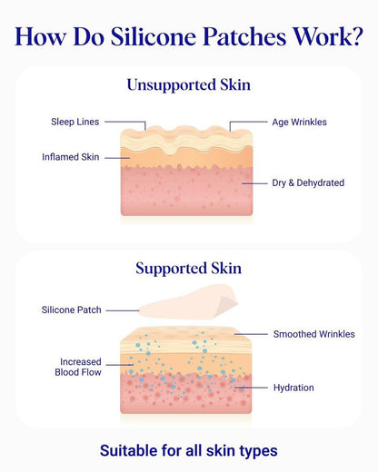 Wrinkles Schminkles Gesichtsglättungsset – Mund- & Lippen-Pads (2er-Pack), Augen-Faltenpflaster (3 Paare), Stirn-Faltenpflaster (2er-Pack) – Wiederverwendbare, hautfreundliche Silikon-Glättungspads