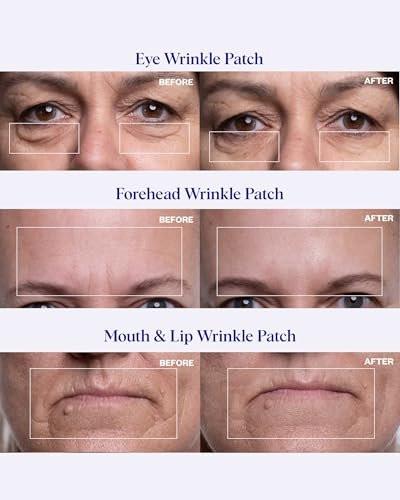 Wrinkles Schminkles Gesichtsglättungsset – Mund- & Lippen-Pads (2er-Pack), Augen-Faltenpflaster (3 Paare), Stirn-Faltenpflaster (2er-Pack) – Wiederverwendbare, hautfreundliche Silikon-Glättungspads