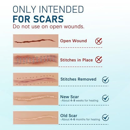 MEDLOT Silikon-Narbenpflaster, 10 Stück, wiederverwendbare Silikonstreifen zur Narbenbehandlung, für Kaiserschnitt, Keloid, Dehnungsstreifen, Verbrennungen, Aknenarben, je 1,5 x 6 Zoll