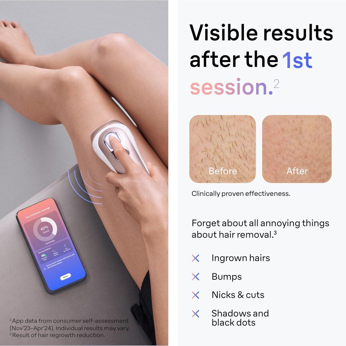 Braun Smart IPL Skin i·Expert Pro 7 – Dauerglatte Haarentfernung für Zuhause mit intelligenter App