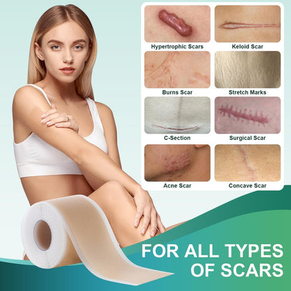 Medizinisches Silikon-Narbenpflaster, Silikon-Narbenband (1,6 Zoll x 60 Zoll Rolle – 1,5 m), professionelle Narbenentfernungsbehandlung, wiederverwendbarer Silikon-Narbenstreifen für Keloid, Kaiserschnitt, Operationen, Verbrennungen, Akne usw.