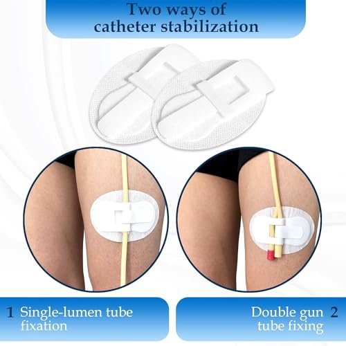 Foley-Katheter-Fixierungsband – Beinbeutelhalter für Katheter, 10er-Pack