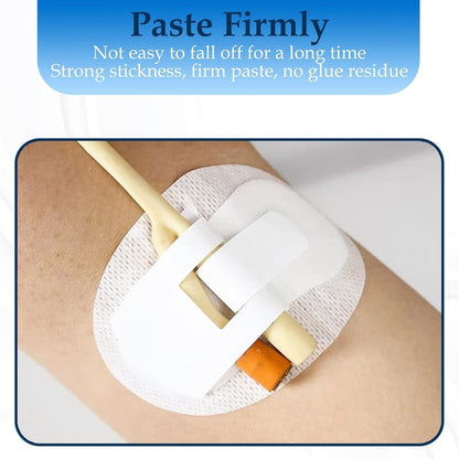 Foley-Katheter-Fixierungsband – Beinbeutelhalter für Katheter, 10er-Pack