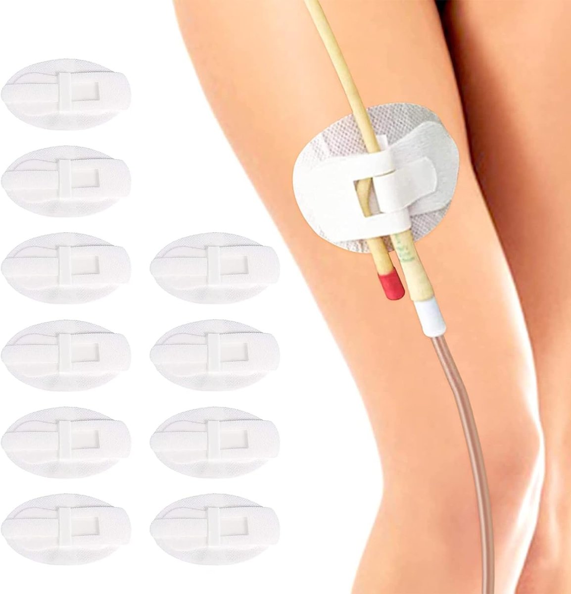 Foley-Katheter-Fixierungsband – Beinbeutelhalter für Katheter, 10er-Pack