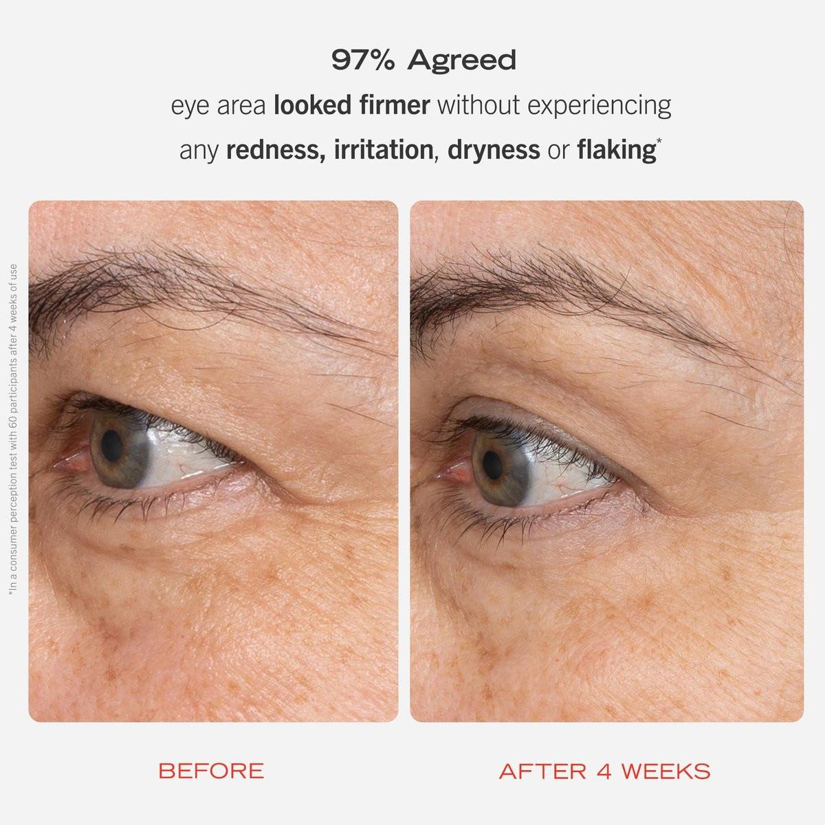 First Aid Beauty Retinol Augencreme mit Squalan + Ceramiden, verkapseltes Retinol-Serum für empfindliche Haut, verbessert das Erscheinungsbild von feinen Linien und Fältchen, 0,5 oz