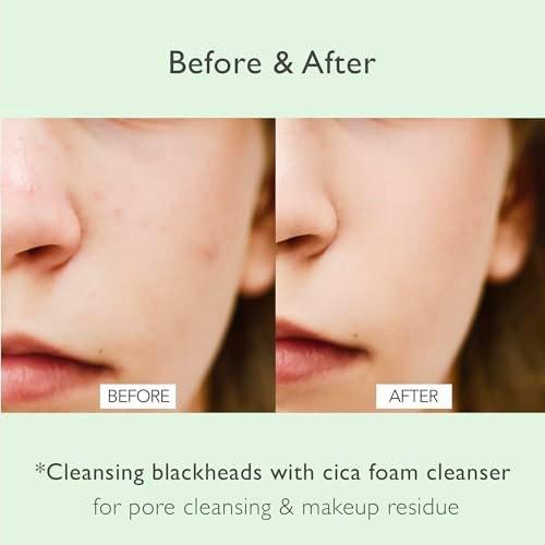 NOWATER Korean Foaming Face Wash mit Centella (Cica) – Porenreinigender Schaumreiniger für fettige & zu Akne neigende Haut, Hyaluronsäure, Aloe Vera & AHA BHA, tägliche sanfte Talgkontrolle, 120 ml