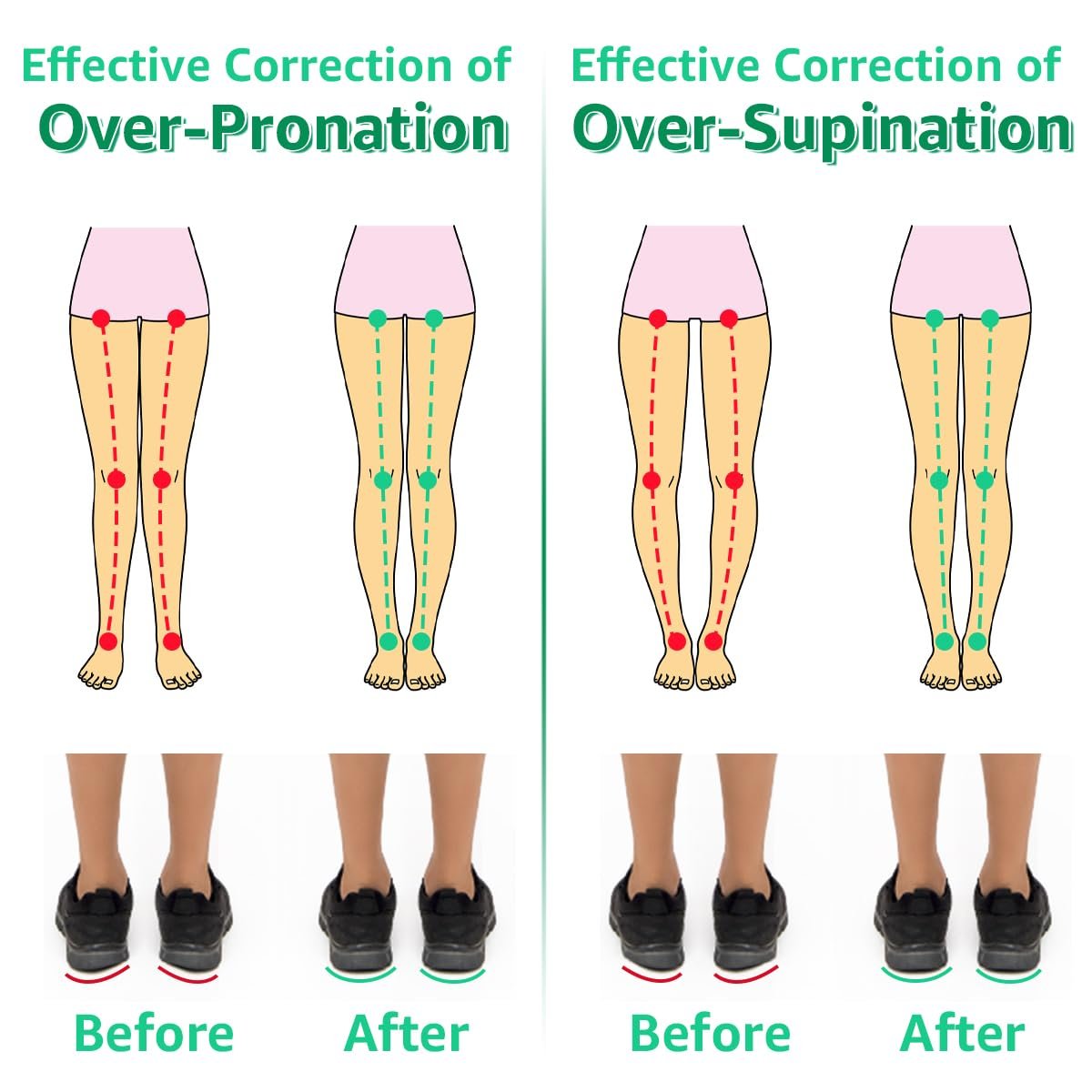 Skyfoot 3-Lagen Verstellbare Fersenkeil-Einlagen zur Korrektur von Supination & Pronation, Klebende mediale & laterale Fersenpolster für O-Beine, Knieschmerzen, Fußausrichtung (L: Damen 7-11, Herren 7-10, Kristall)