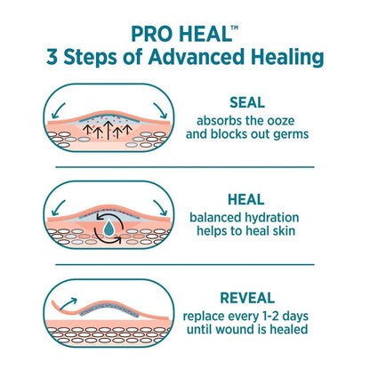 BAND-AID Brand Pro Heal Hydrokolloid-Pflaster, wasserdicht, zur ersten Hilfe bei Blasen und kleinen Wunden, klinisch getestet für bessere Heilung, Einheitsgröße, 10 Stück
