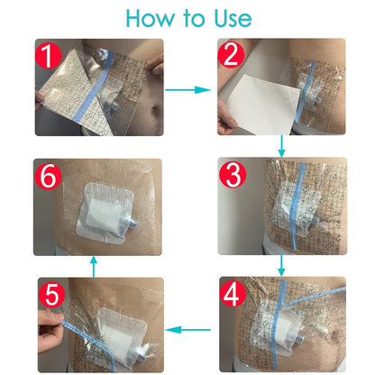 Hola Health Duschschutz [Packung mit 25], 10" x 12" Dialyse-Katheter-Duschabdeckung, PD-PICC-Linie-Wasserbarriere, wasserdichter Wundverband-Schutz, Einweg, Transparent