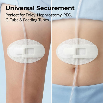 20-teiliges Katheterfixierungsset, Katheterhalter, Harnröhrenfixierungspflaster für Nephrostomie, PEG, G-Sonde, Klebeband mit Klettverschluss für Katheter, weiß