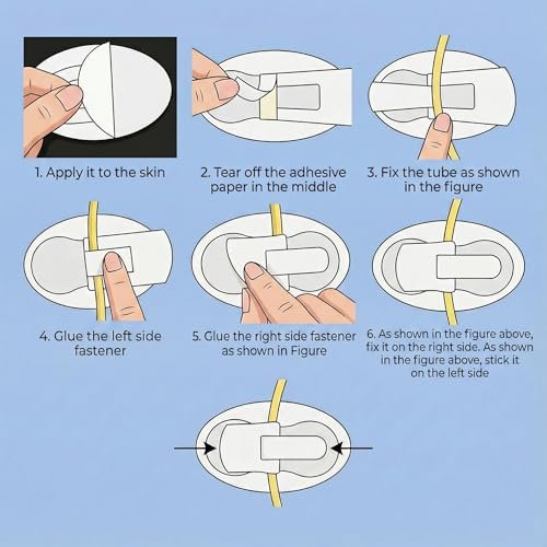 20-teiliges Katheterfixierungsset, Katheterhalter, Harnröhrenfixierungspflaster für Nephrostomie, PEG, G-Sonde, Klebeband mit Klettverschluss für Katheter, weiß