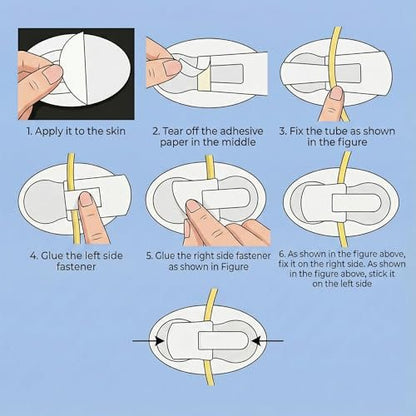 20-teiliges Katheterfixierungsset, Katheterhalter, Harnröhrenfixierungspflaster für Nephrostomie, PEG, G-Sonde, Klebeband mit Klettverschluss für Katheter, weiß