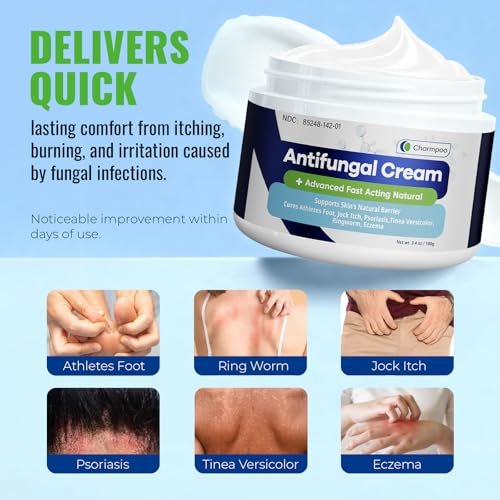 CHARMPOO Antimykotische Creme mit 2% Miconazol gegen Juckreiz, Fußpilz und Ringelflechte – Schnell einziehende Creme für Füße, Leisten und Körperfalten, 100 g
