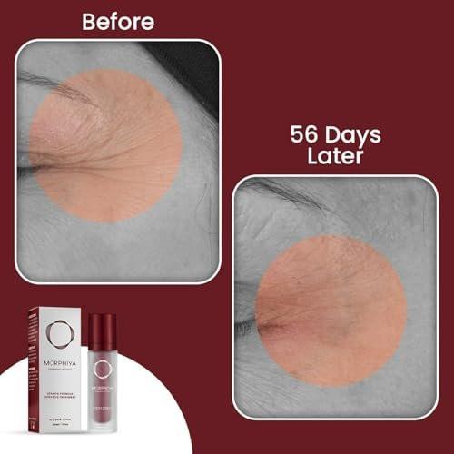 Morphiya Genesis Formula Intensive Treatment 30 ml – Hochwirksame Gesichtsbehandlung
