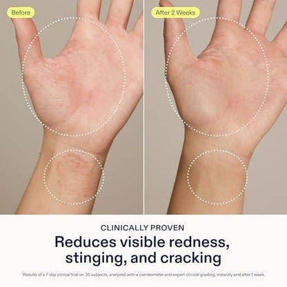 Skinfix Hand Relief Cream - 3 fl oz - Reduziert sichtbare Rötungen, Stechen und Rissbildung bei trockener, empfindlicher Haut - Von der National Eczema Association akzeptiert - Duftfrei - Vegan, tierversuchsfrei