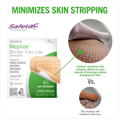Mepilex Border Flex Lite 3 x 3 Zoll (7,5 x 7,5 cm) – Krankenhausqualität Wundauflage für kleine chirurgische Wunden, Schürfwunden und Blasen – Mehrlagig haftend für den mehrtägigen Einsatz