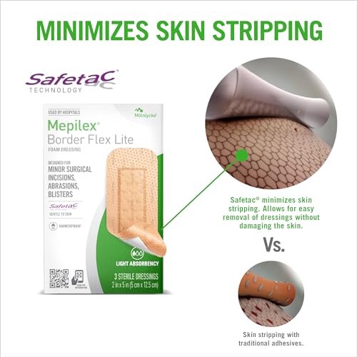 Mepilex Border Flex Lite 2 x 5 Zoll (5x12,5 cm) Krankenhausqualität Wundauflagen für kleinere chirurgische Schnitte, Schürfwunden und Blasen bis zu mehreren Tagen Anwendung
