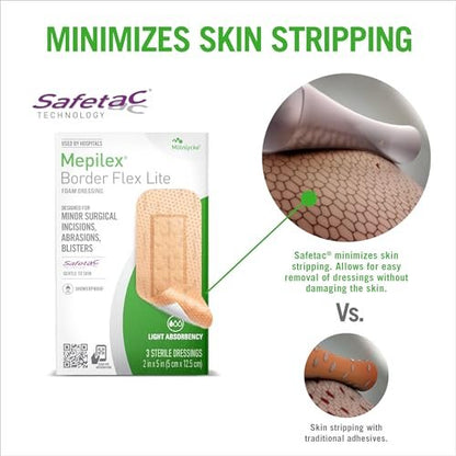 Mepilex Border Flex Lite 2 x 5 Zoll (5x12,5 cm) Krankenhausqualität Wundauflagen für kleinere chirurgische Schnitte, Schürfwunden und Blasen bis zu mehreren Tagen Anwendung