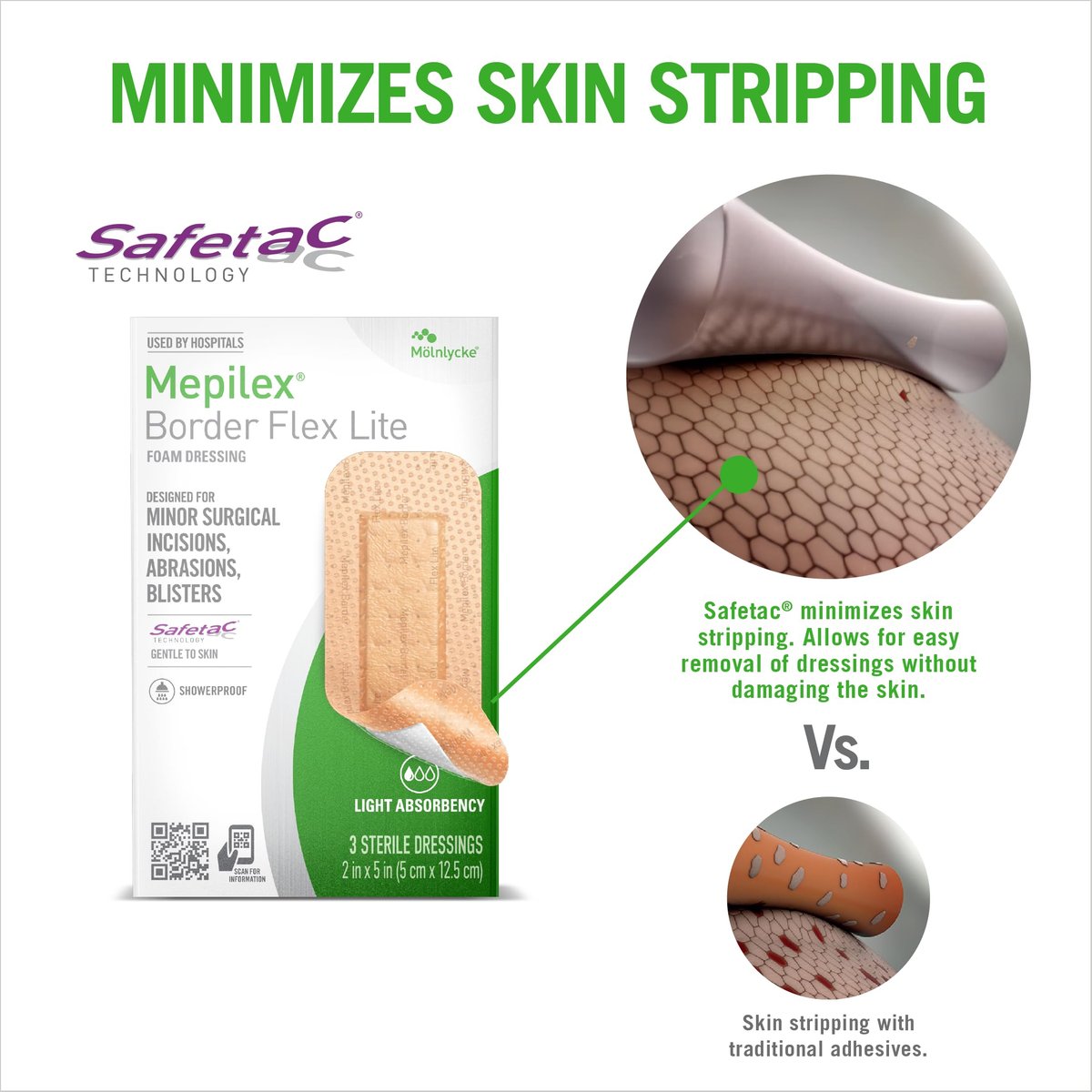 Mepilex Border Flex Lite 2 x 5 Zoll (5x12,5 cm) Krankenhausqualität Wundauflagen für kleinere chirurgische Schnitte, Schürfwunden und Blasen bis zu mehreren Tagen Anwendung